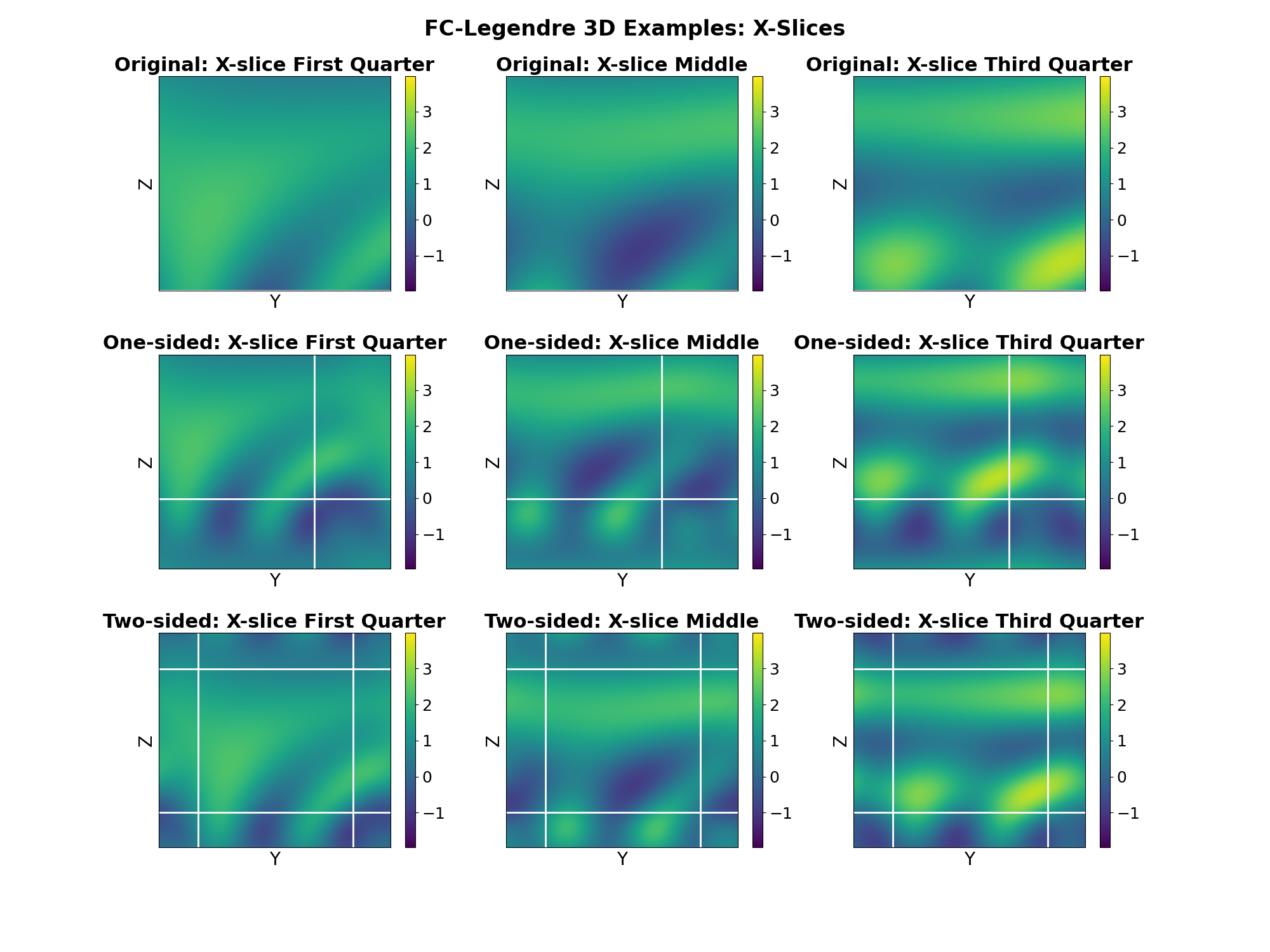 FC-Legendre 3D Examples: X-Slices, Original: X-slice First Quarter, One-sided: X-slice First Quarter, Two-sided: X-slice First Quarter, Original: X-slice Middle, One-sided: X-slice Middle, Two-sided: X-slice Middle, Original: X-slice Third Quarter, One-sided: X-slice Third Quarter, Two-sided: X-slice Third Quarter