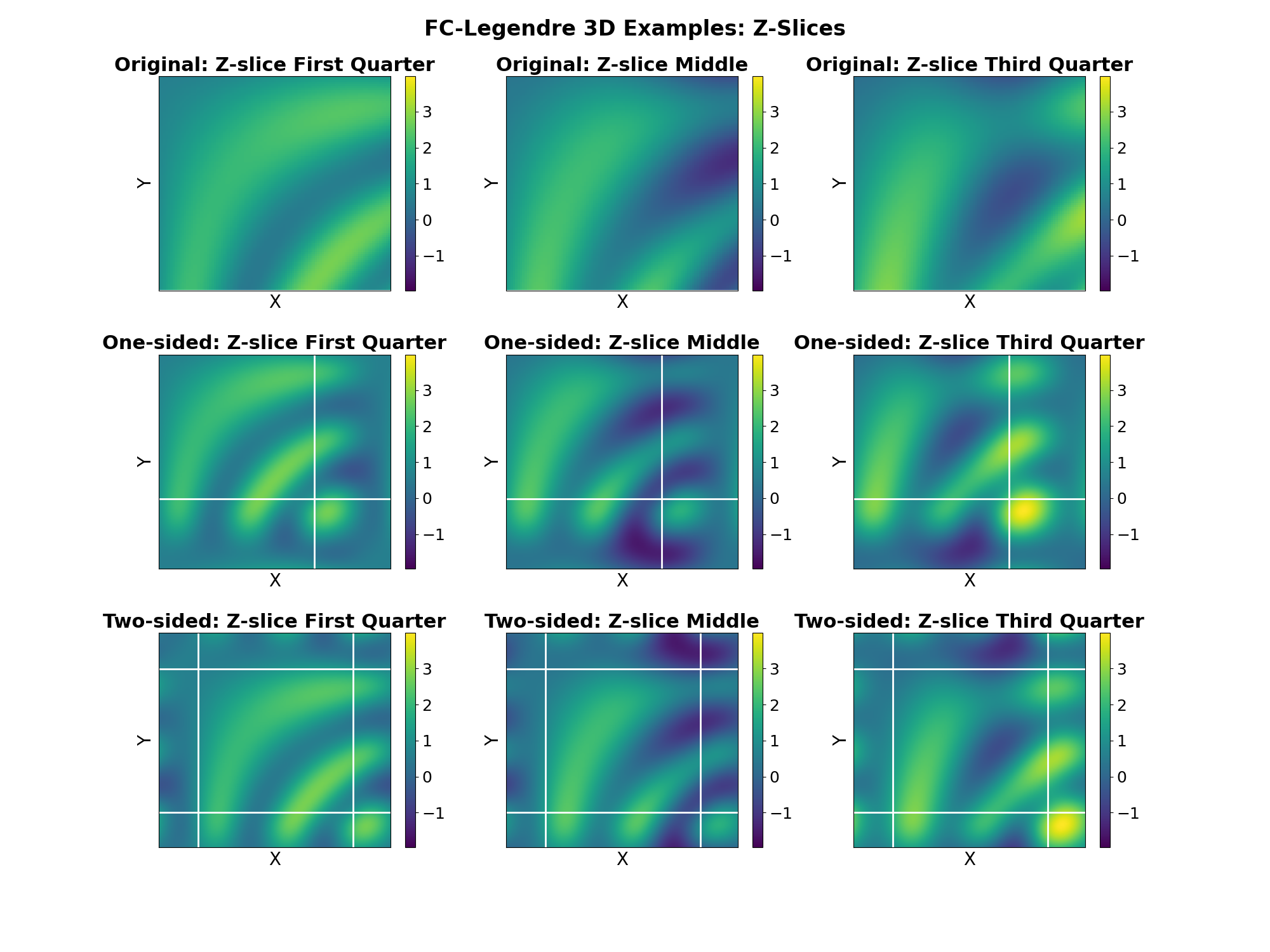 FC-Legendre 3D Examples: Z-Slices, Original: Z-slice First Quarter, One-sided: Z-slice First Quarter, Two-sided: Z-slice First Quarter, Original: Z-slice Middle, One-sided: Z-slice Middle, Two-sided: Z-slice Middle, Original: Z-slice Third Quarter, One-sided: Z-slice Third Quarter, Two-sided: Z-slice Third Quarter