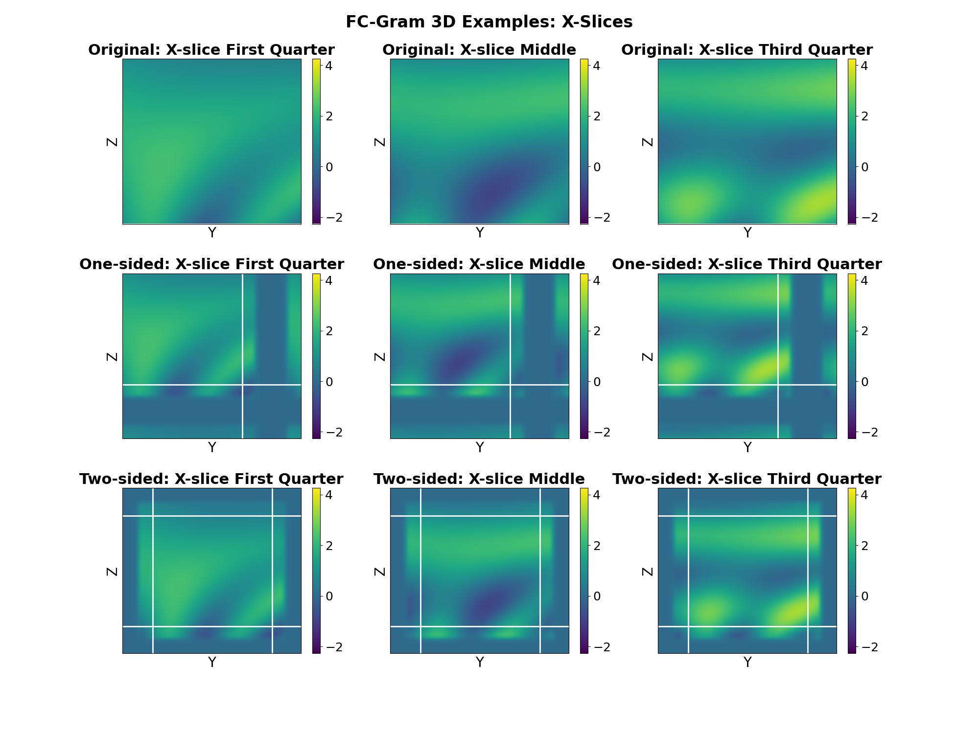 FC-Gram 3D Examples: X-Slices, Original: X-slice First Quarter, One-sided: X-slice First Quarter, Two-sided: X-slice First Quarter, Original: X-slice Middle, One-sided: X-slice Middle, Two-sided: X-slice Middle, Original: X-slice Third Quarter, One-sided: X-slice Third Quarter, Two-sided: X-slice Third Quarter